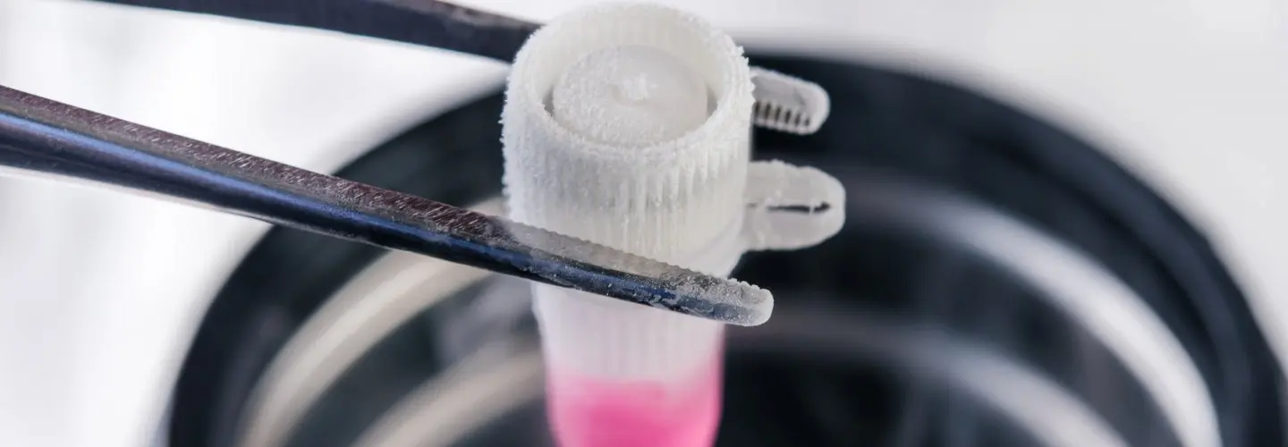Embriyo Dondurma Tekniği: Vitrifikasyon